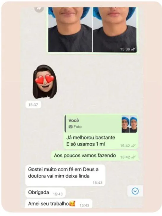 Depoimento de cliente da Botolips 1